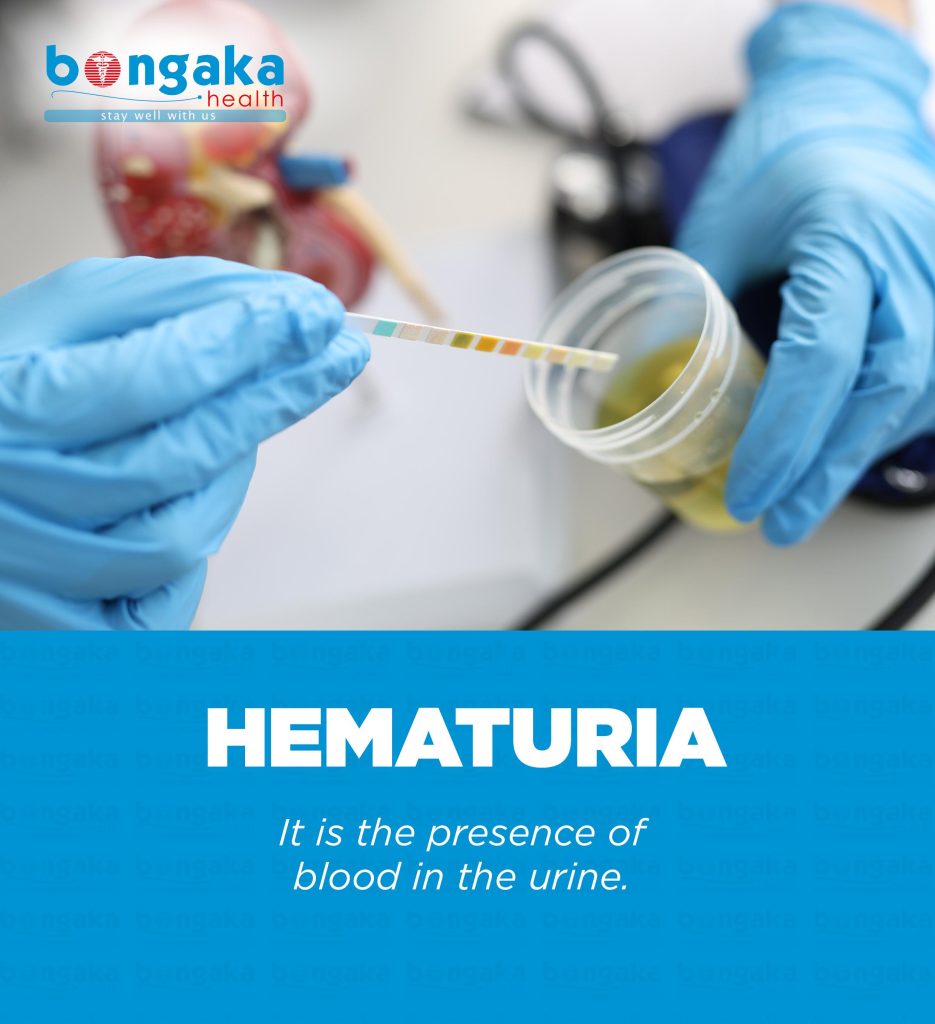 Hematuria